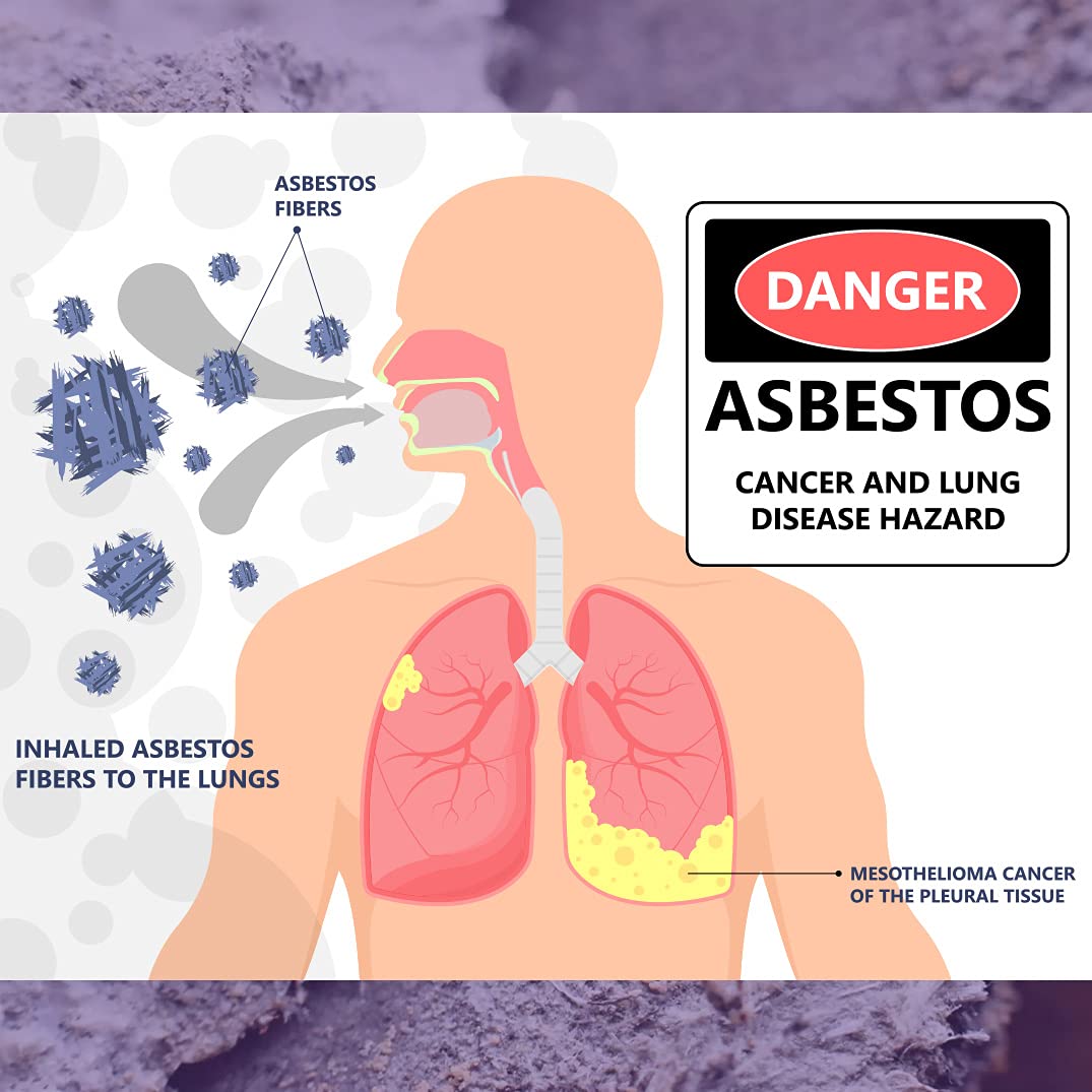 ProLab Asbestos Test Kit -You collect 2 samples, We analyze them. Emailed results within 1 week (5 Business days) Includes return mailer and Expert Consultation. $40 fee required to analyze the 2 samples (AS108)